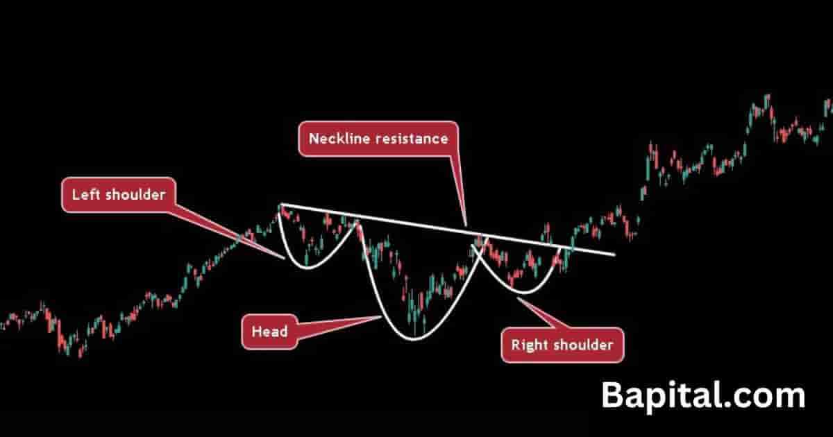 Inverse head & shoulder pattern components